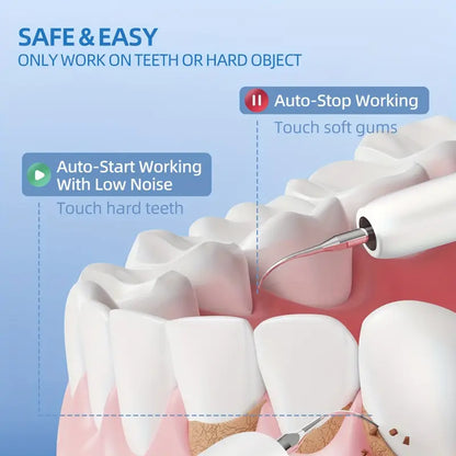 DentaLume™ – Nettoyeur Dentaire Électrique avec Lumière LED et Recharge USB