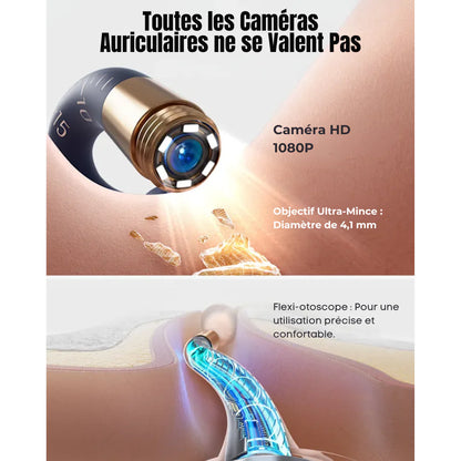 Bebird EarSight Plus Ohrreiniger